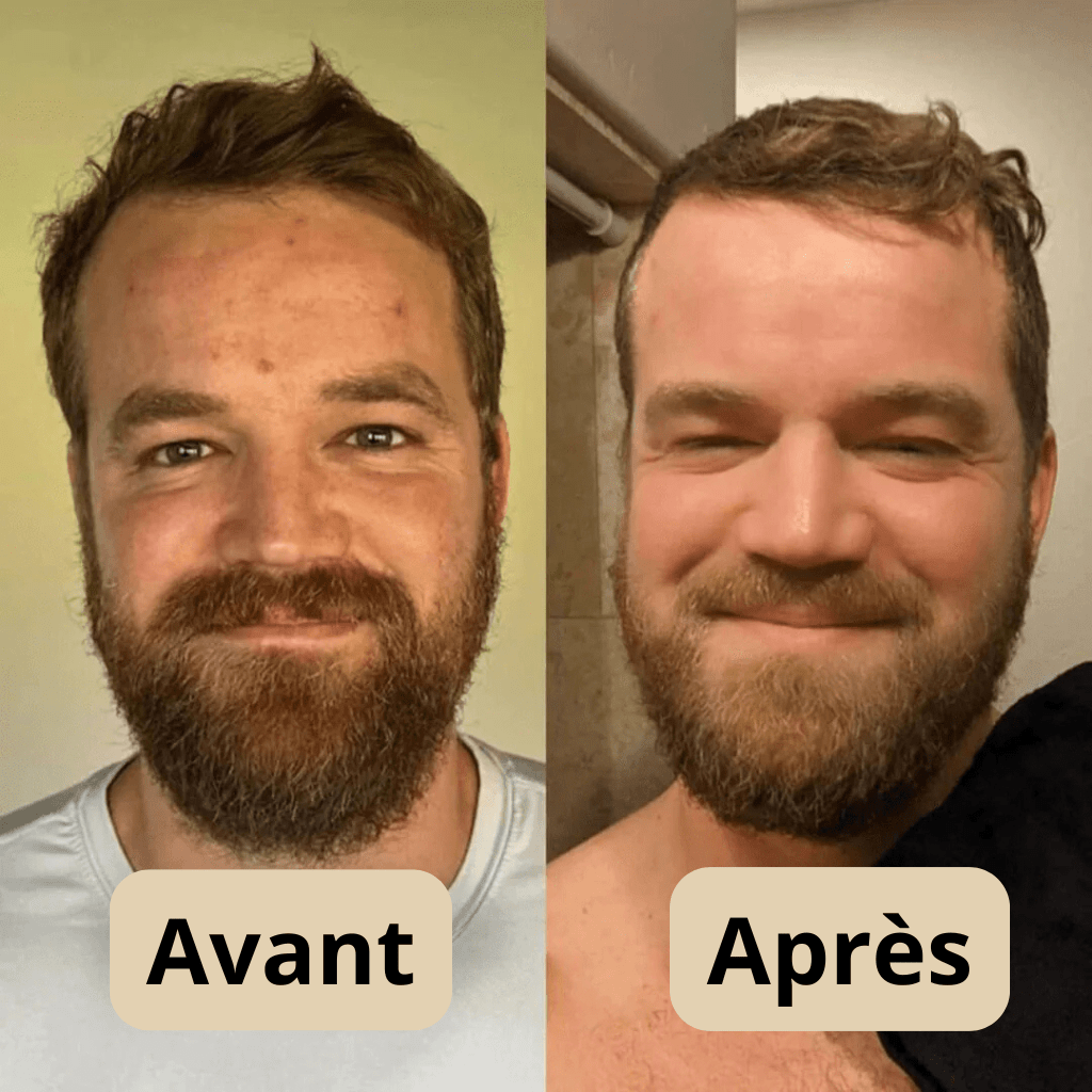 Peel Shot Coréen - Élimine les Impuretés et Sublime Votre Peau