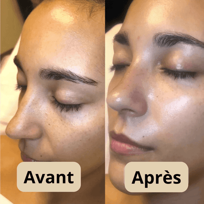 Peel Shot Coréen - Élimine les Impuretés et Sublime Votre Peau