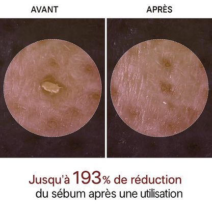 Peel Shot Coréen - Élimine les Impuretés et Sublime Votre Peau